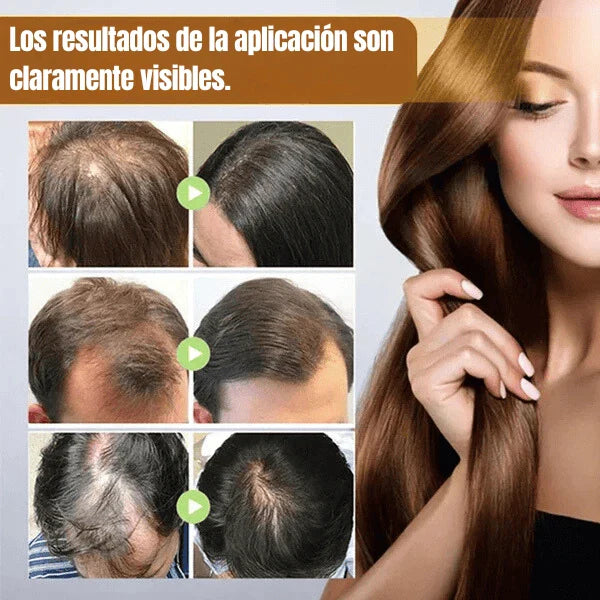 BIOTIN SERUM PREMIUM | Recupera el cabello y Detiene la Caída