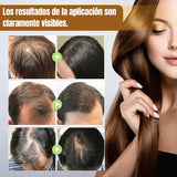 BIOTIN SERUM PREMIUM | Recupera el cabello y Detiene la Caída