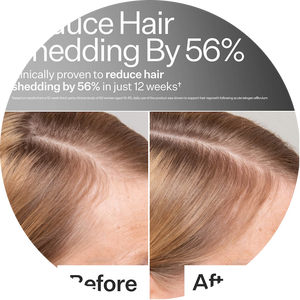 2% Stem Cell H-2 Grow Complex ™ Scalp Serum For Thicker-Looking Hair